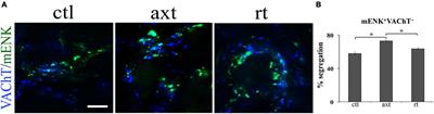 Functional Implications of Neurotransmitter Segregation